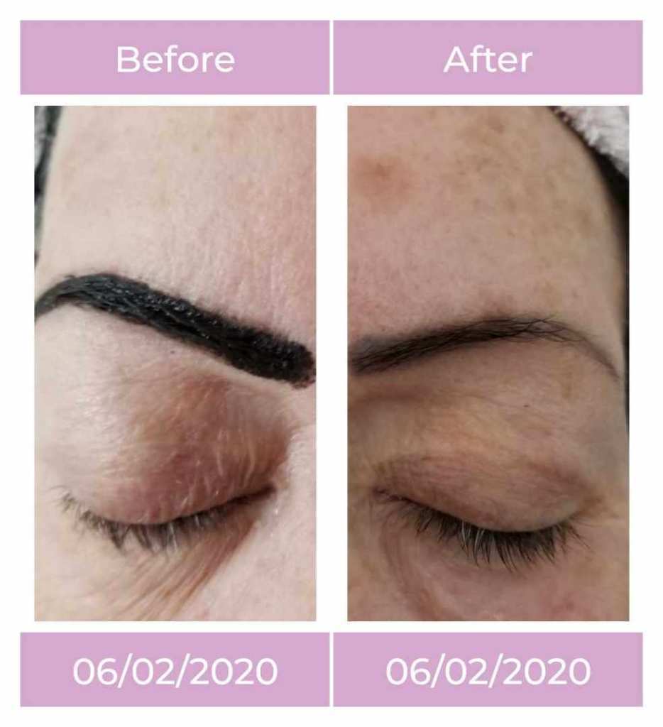 Before and after brow work at Aristo Brows